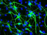 Найден главный фактор долголетия мозга