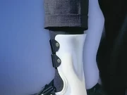 Послеоперационная обувь: виды, показания