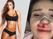 «Я больше не буду молчать и терпеть»: девушка футболиста «Балтики» Гогричиани обвинила его в насилии