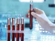 Сотрудник американской медицинской организации раскрыл тайны черных трансплантологов из Львова