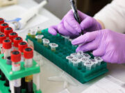 Скрининг болезни Фабри: как выявить опасную генетику на ранней стадии