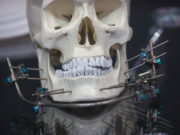 Врач объяснила, может ли ношение брекетов состарить лицо человека