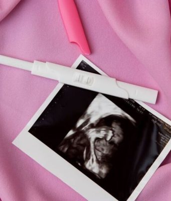 Женщина родила здорового ребенка после «неслыханной» внематочной беременности