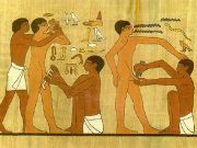 В европейской стране обрезание сочли «жестоким обращением с детьми»